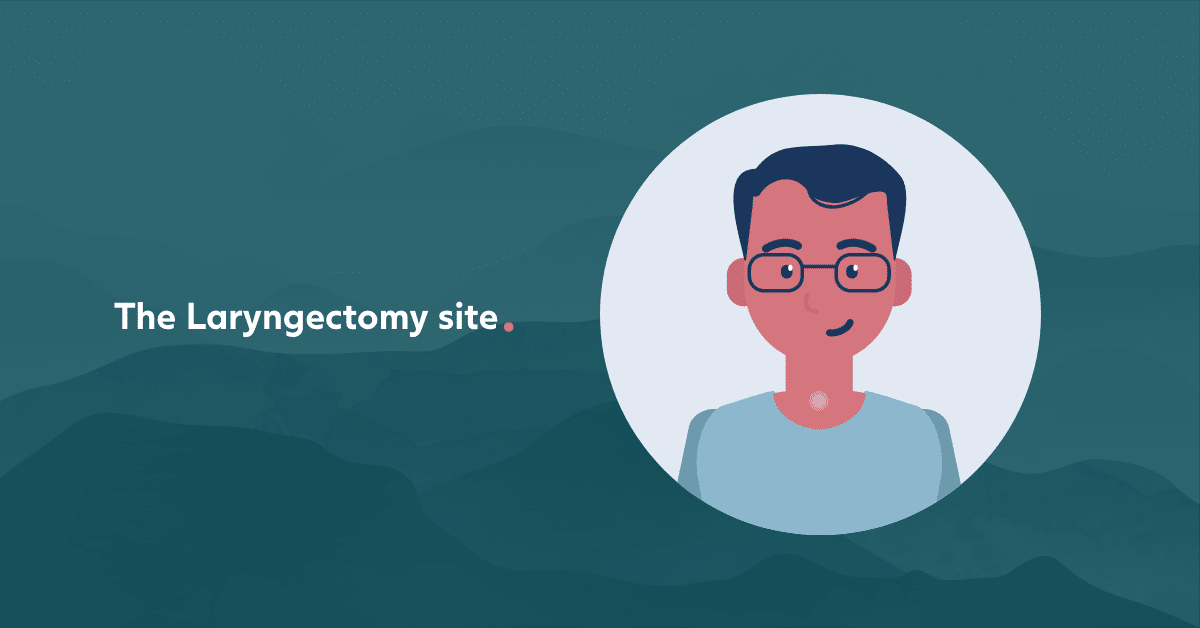 Patient's story - The Laryngectomy Site